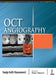 Oct Angiography by Sefic Sanja Kasumovic