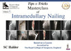 Tips & Tricks Masterclass Of Intramedullary Nailing by Subhash Ch Halder