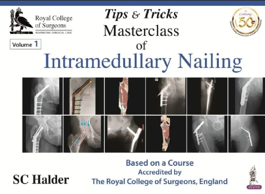 Tips & Tricks Masterclass Of Intramedullary Nailing by Subhash Ch Halder