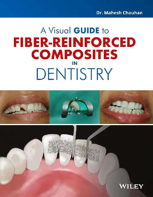 A Visual Guide to Fiber-Reinforced Composites in Dentistry by Dr. Mahesh Chauhan