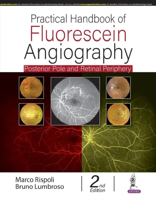 Practical Handbook Of Fluorescein Angiography: Posterior And Retinal Periphery by Marco Rispoli