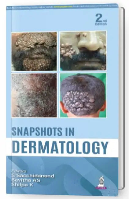 Snapshots In Dermatology by S Sacchidanand