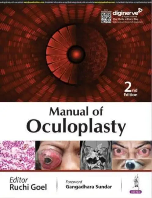 Manual Of Oculoplasty by Ruchi Goel