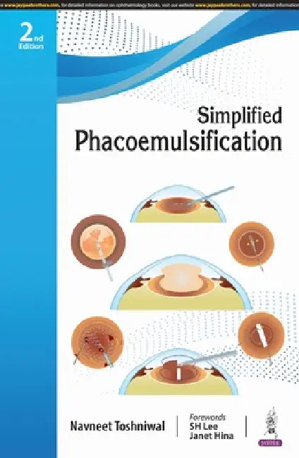 Simplified Phacoemulsification by Navneet Toshniwal