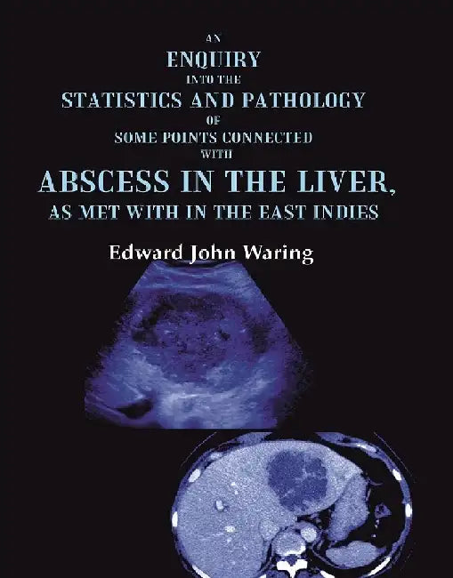 An Enquiry Into The Statistics and Pathology of Some Points Connected With Abscess In The Liver, As Met With In The East Indies by Edward John Waring