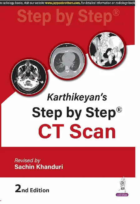 Karthikeyan's Step By Step Ct Scan by Sachin Khanduri