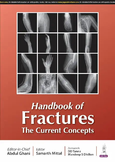 Handbook Of Fractures The Current Concepts by Abdul Ghani