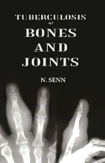 Tuberculosis of Bones and Joints by N. Senn
