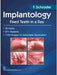 Implantology: Fixed Teeth in a Day by F. Schrader