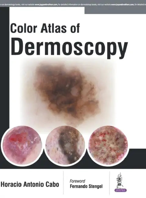 Color Atlas Of Dermoscopy by Horacio Antonio Cabo