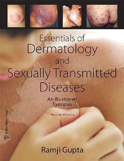 Essentials of Dermatology and Sexually Transmitted Disease: An Illustrated Synopsis by Dr Ramji Gupta