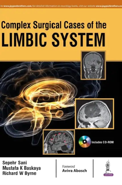 Complex Surgical Cases Of The Limbic System by Sepehr Sani