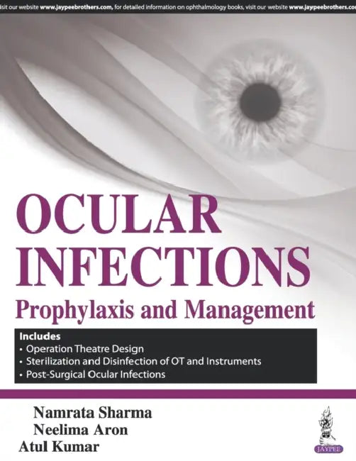 Ocular Infections Prophylaxis And Management by Namrata Sharma
