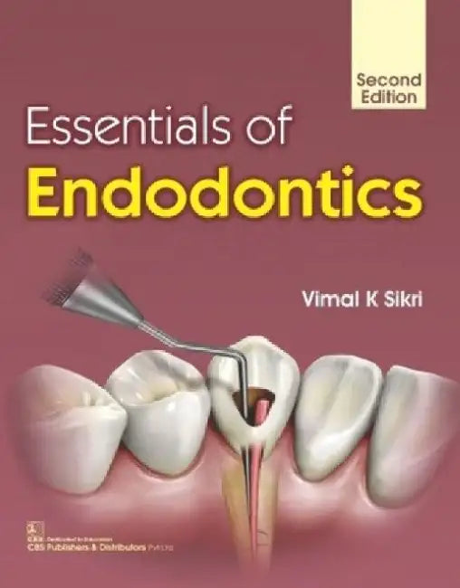 Essentials of Endodontics by Vimal K. Sikri
