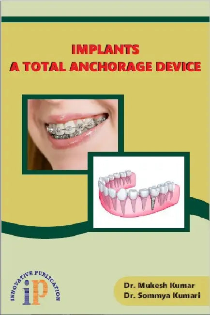 Implants - A Total Anchorage Device by Dr. Mukesh Kumar