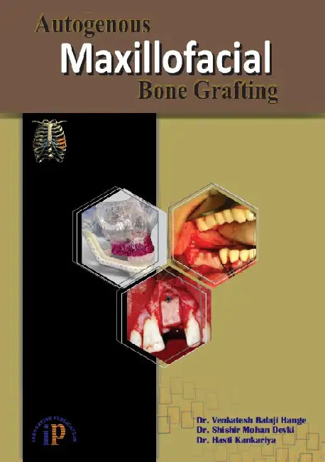 Autogenous Maxillofacial Bone Grafting by Dr. Venkatesh Balaji Hange