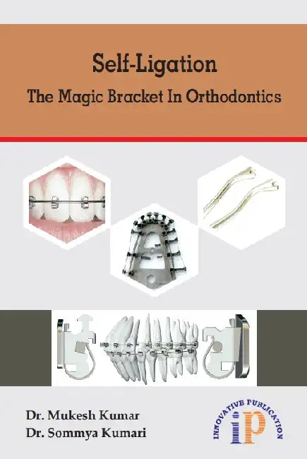 Self-Ligation - The Magic Bracket in Orthodontics by Dr. Mukesh Kumar