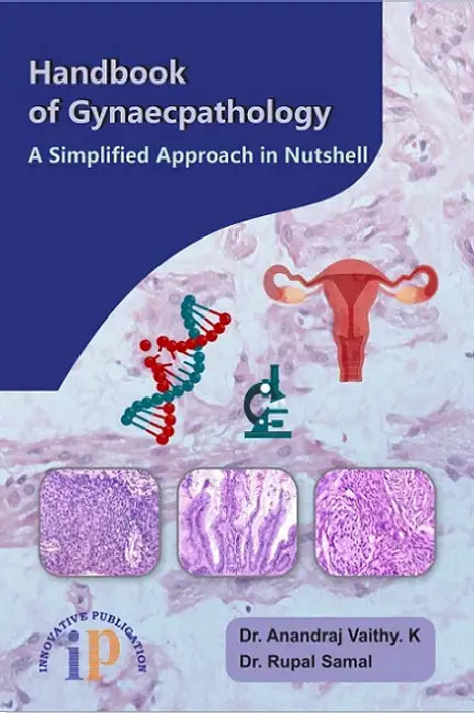 Handbook of Gynaecpathology – A Simplified Approach in Nutshell by Dr. Anandraj Vaithy. K