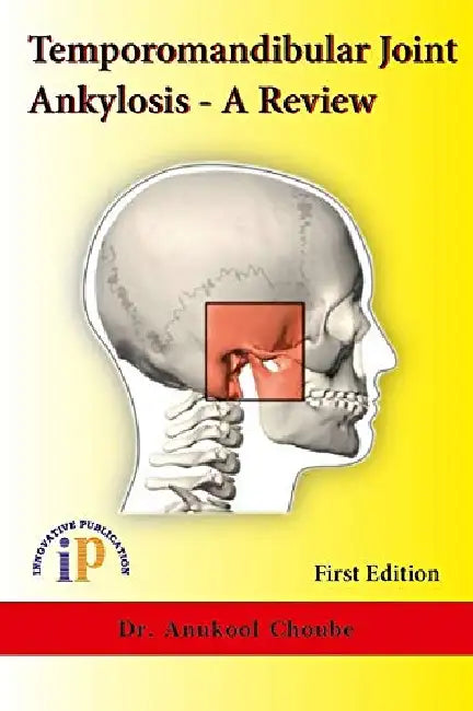 Temporomandibular Joint Ankylosis – A Review by Dr. Anukool Choube