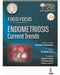 FOGSI Focus Endometriosis: Current Trends by Nandita Palshetkar