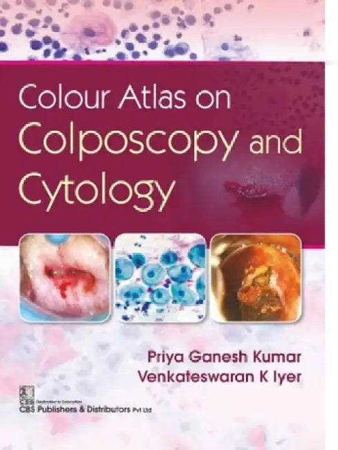 Colour Atlas on Colposcopy and Cytology by Priya Ganesh Kumar