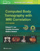 Computed Body Tomography with MRI Correlation, 5e by Lee