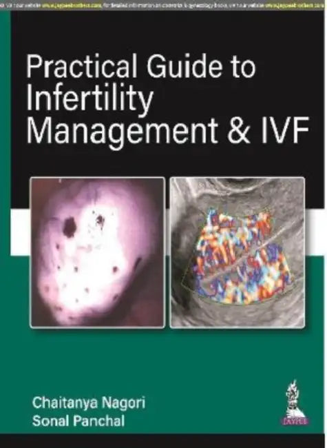 Practical Guide To Infertility Management & Ivf by Chaitanya Nagori