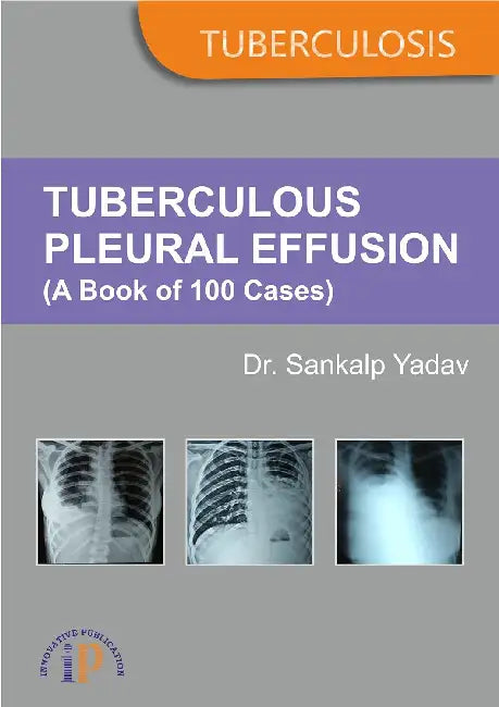 Tuberculous Pleural Effusion (A Book of 100 Cases) by Dr. Sankalp Yadav