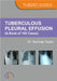 Tuberculous Pleural Effusion (A Book of 100 Cases) by Dr. Sankalp Yadav