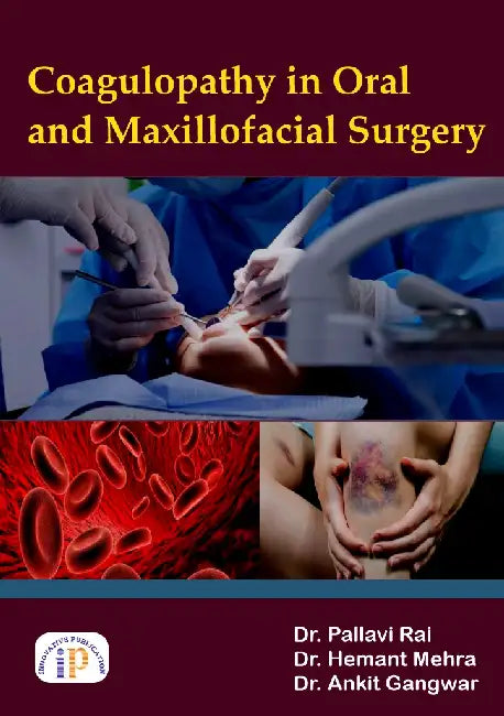 Coagulopathy in Oral and Maxillofacial Surgery by Dr. Pallavi Rai