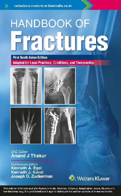 Handbook Of Fractures Adapted For Local Practices Conditions And Therapeutics With Access Code by Thakur A.J.