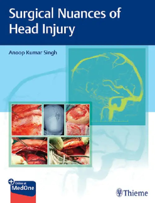Surgical Nuances of Head Injury by Anoop Singh