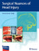 Surgical Nuances of Head Injury by Anoop Singh