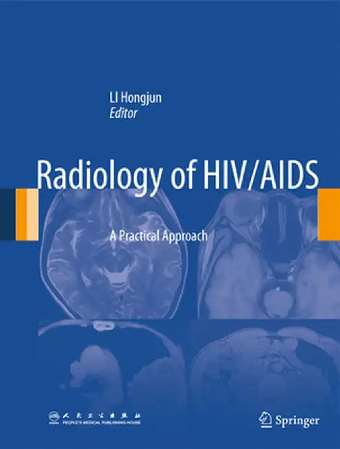 Radiology of HIV/AIDS: A Practical Approach by Hongjun Li