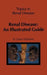 Renal Disease: An Illustrated Guide by D. G. Williams