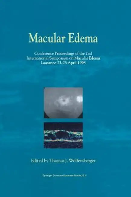 Macular Edema: Conference Proceedings of the 2nd International Symposium on Macular Edema, Lausanne, 23-25 April 1998 by Thomas J. Wolfensberger
