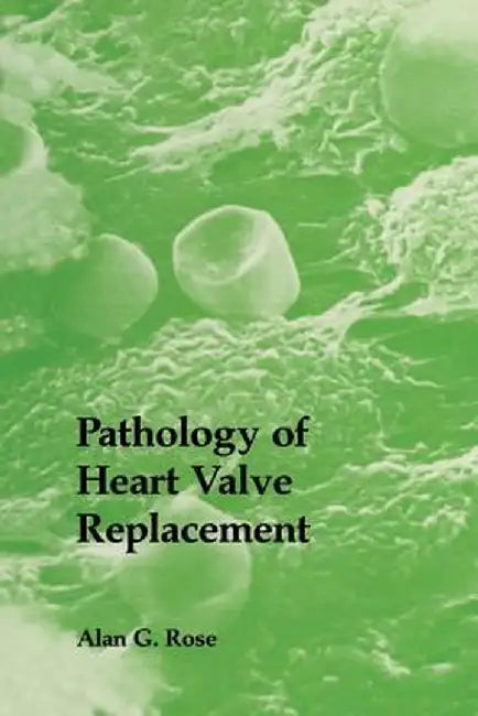 Pathology of Heart Valve Replacement by A. G. Rose