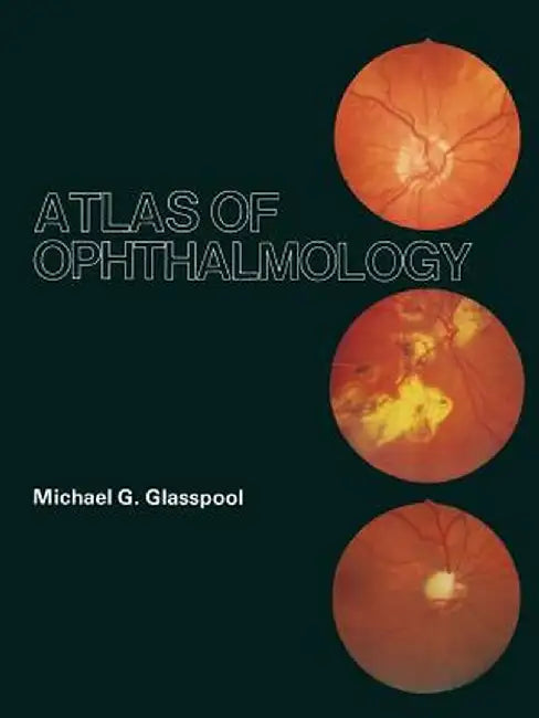 Atlas of Ophthalmology by M. G. Glasspool