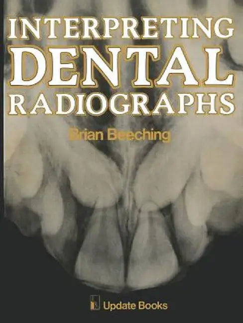Interpreting Dental Radiographs by B. W. Beeching