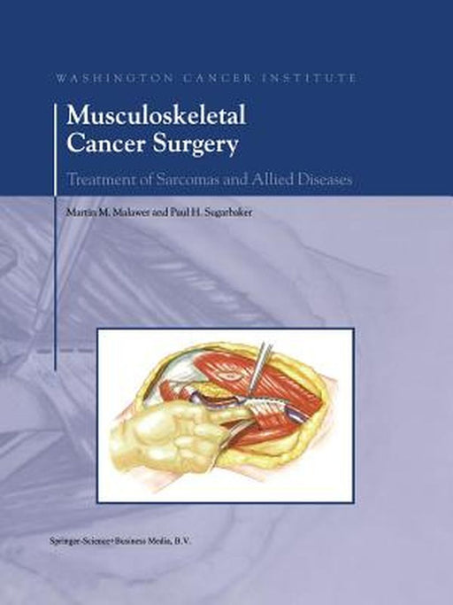 Musculoskeletal Cancer Surgery: Treatment of Sarcomas and Allied Diseases by Martin M. Malawer