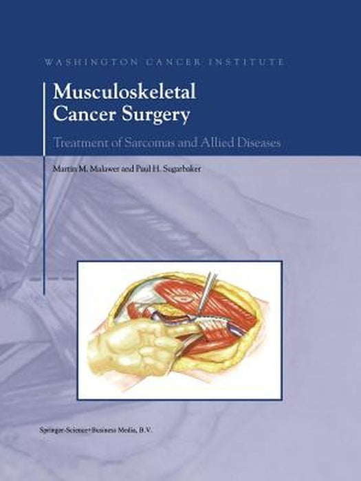 Musculoskeletal Cancer Surgery: Treatment of Sarcomas and Allied Diseases by Martin M. Malawer