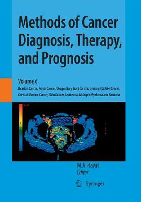Methods of Cancer Diagnosis, Therapy, and Prognosis: Ovarian Cancer, Renal Cancer, Urogenitary Tract Cancer, Urinary Bladder Cancer, Cervical Uterine by M. A. Hayat