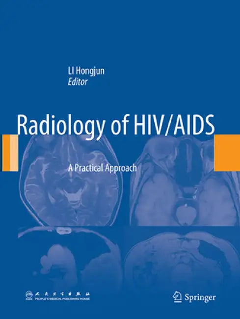 Radiology of HIV/AIDS: A Practical Approach by Hongjun Li