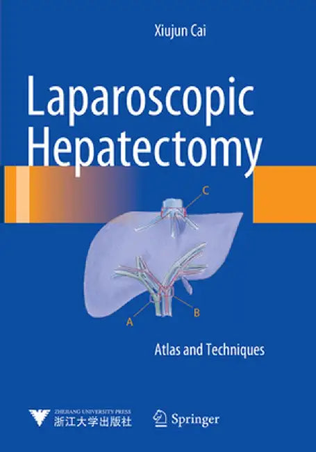 Laparoscopic Hepatectomy: Atlas and Techniques by Xiujun Cai
