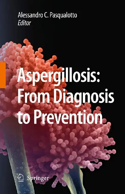 Aspergillosis: From Diagnosis to Prevention by Alessandro Comarú Pasqualotto