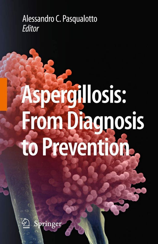 Aspergillosis: From Diagnosis to Prevention by Alessandro Comarú Pasqualotto