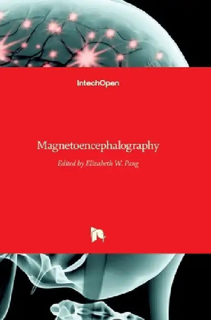 Magnetoencephalography by Elizabeth Pang