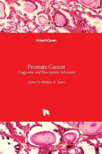 Prostate Cancer: Diagnostic and Therapeutic Advances by Philippe E. Spiess