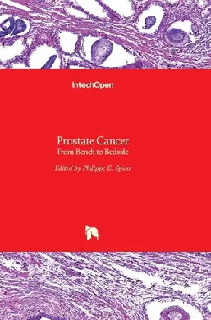 Prostate Cancer: From Bench to Bedside by Philippe E. Spiess