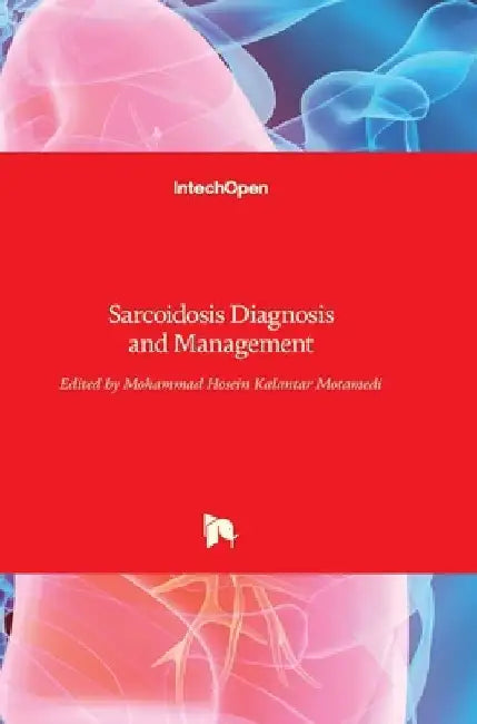 Sarcoidosis: Diagnosis and Management by Mohammad Hosein Motamedi